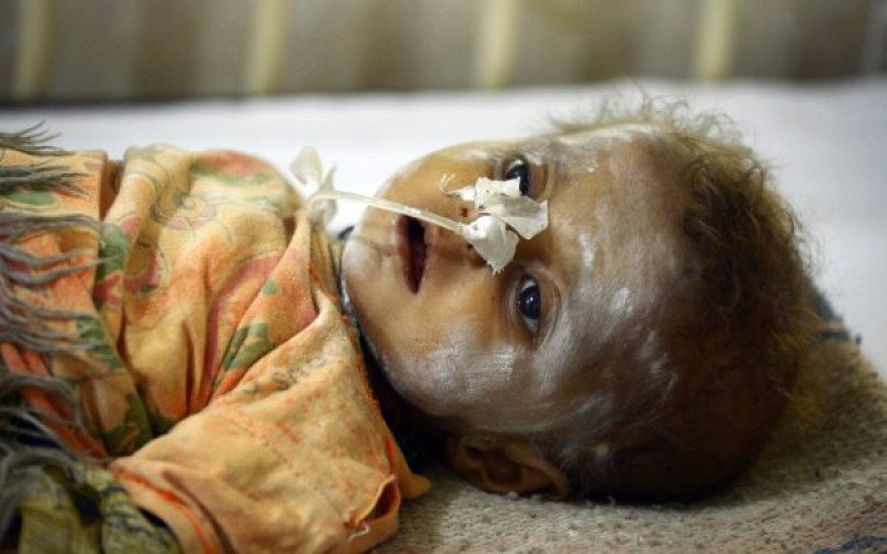 Vague de décès d’enfants dans un désert du sud du Pakistan